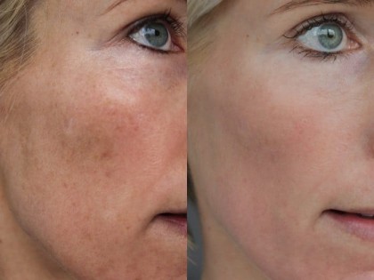 Nimue-12-Week-Challenge-Resultaat-700x525-1