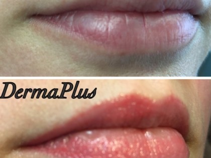 Full_lips_4