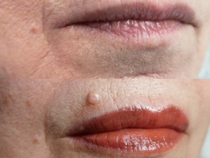 PMU-lip1