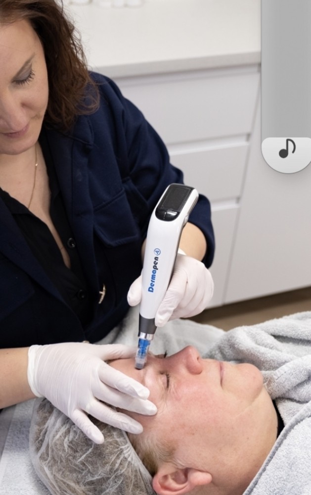 Microneedling